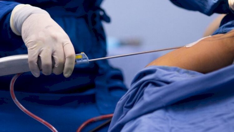 Sumqayıtda 34 yaşlı qadın liposaksiyadan sonra öldü