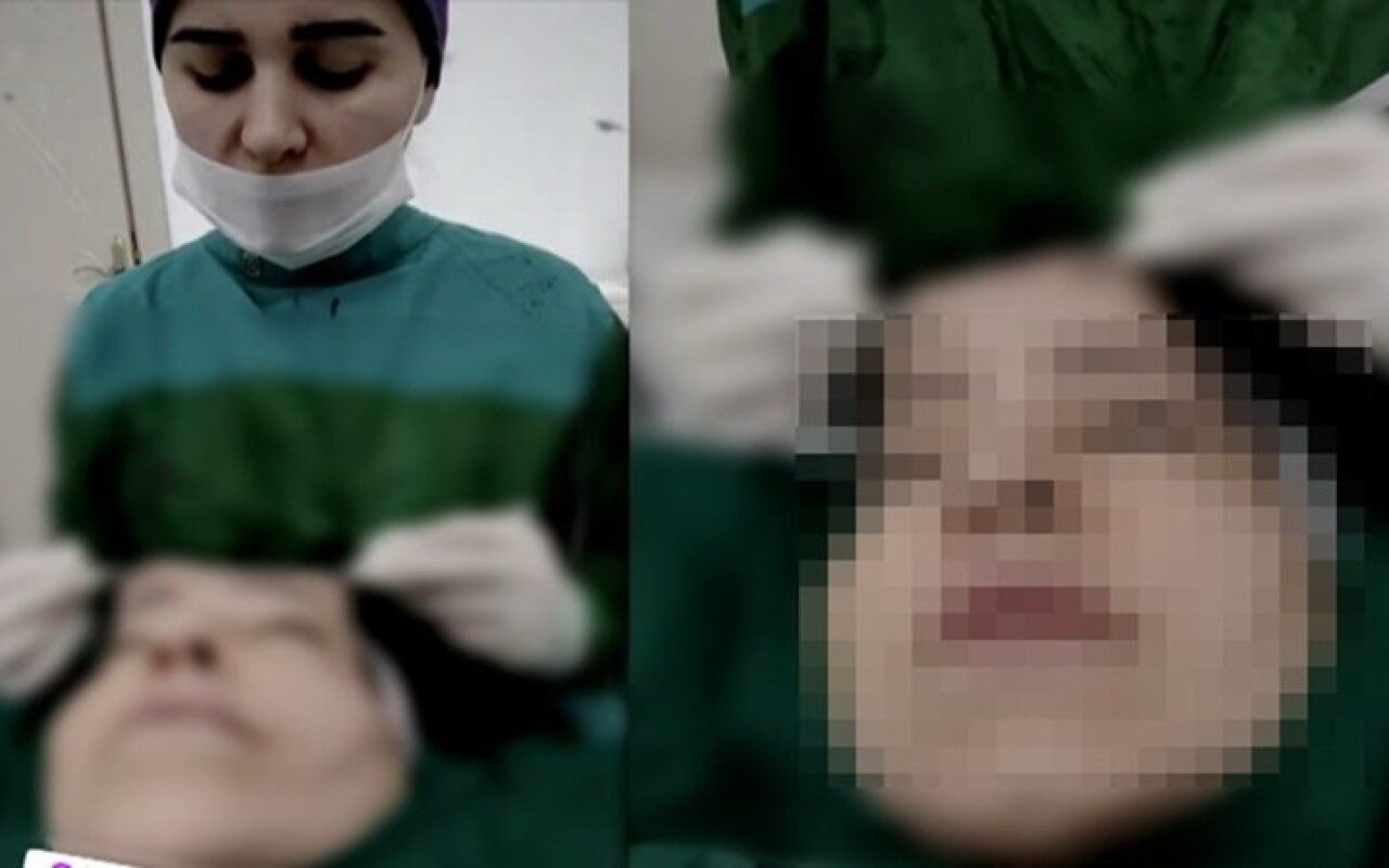 Estetik əməliyyat zamanı canlı yayım açan cərrahla bağlı araşdırma başladı