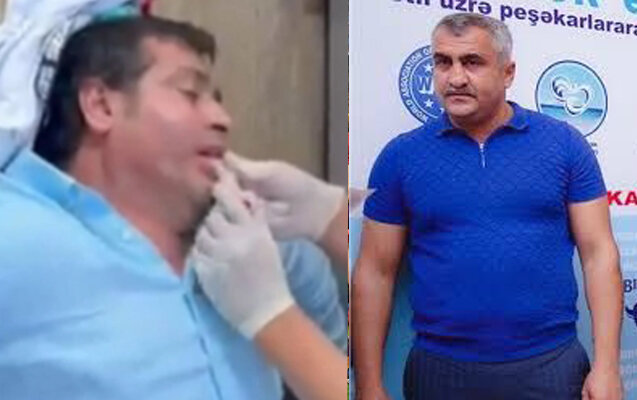 Araz Musayevin bıçaqlanmasına görə 5 nəfər saxlanılıb