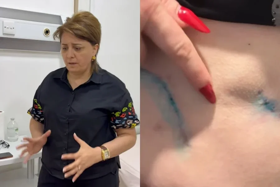 Saxta cərrah barədə şok faktlar: Xəstələri ölümcül hala salır