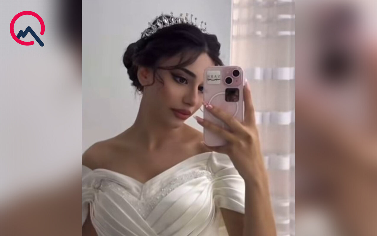Toyuna sayılı günlər vəfat edən Ləmanın  fotoları