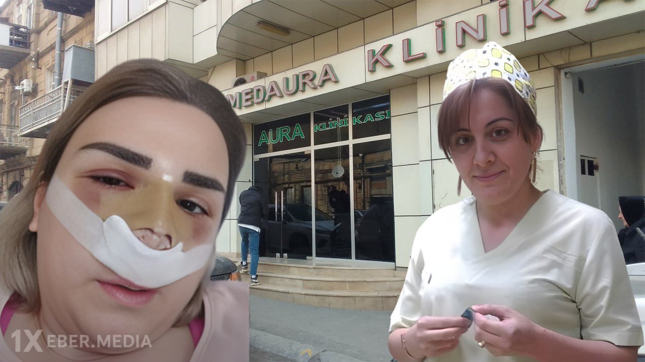 Ölüm saçan “MedAura” klinikası – Uğursuz əməliyyatlara səbəb olan Nigar Məhəmmədova iş başındadır?