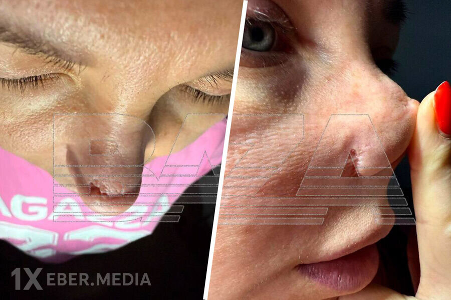 Əməliyyat olunan qadın cərrah Seymur Əliyevdən şikayətçi oldu