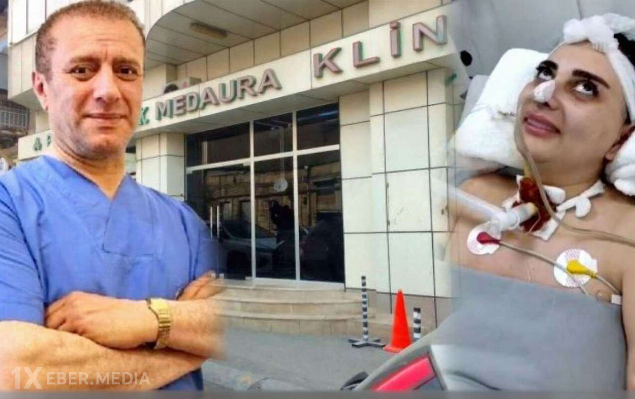 Komaya düşən Nigara görə həkimlərə cinayət işi açılıb