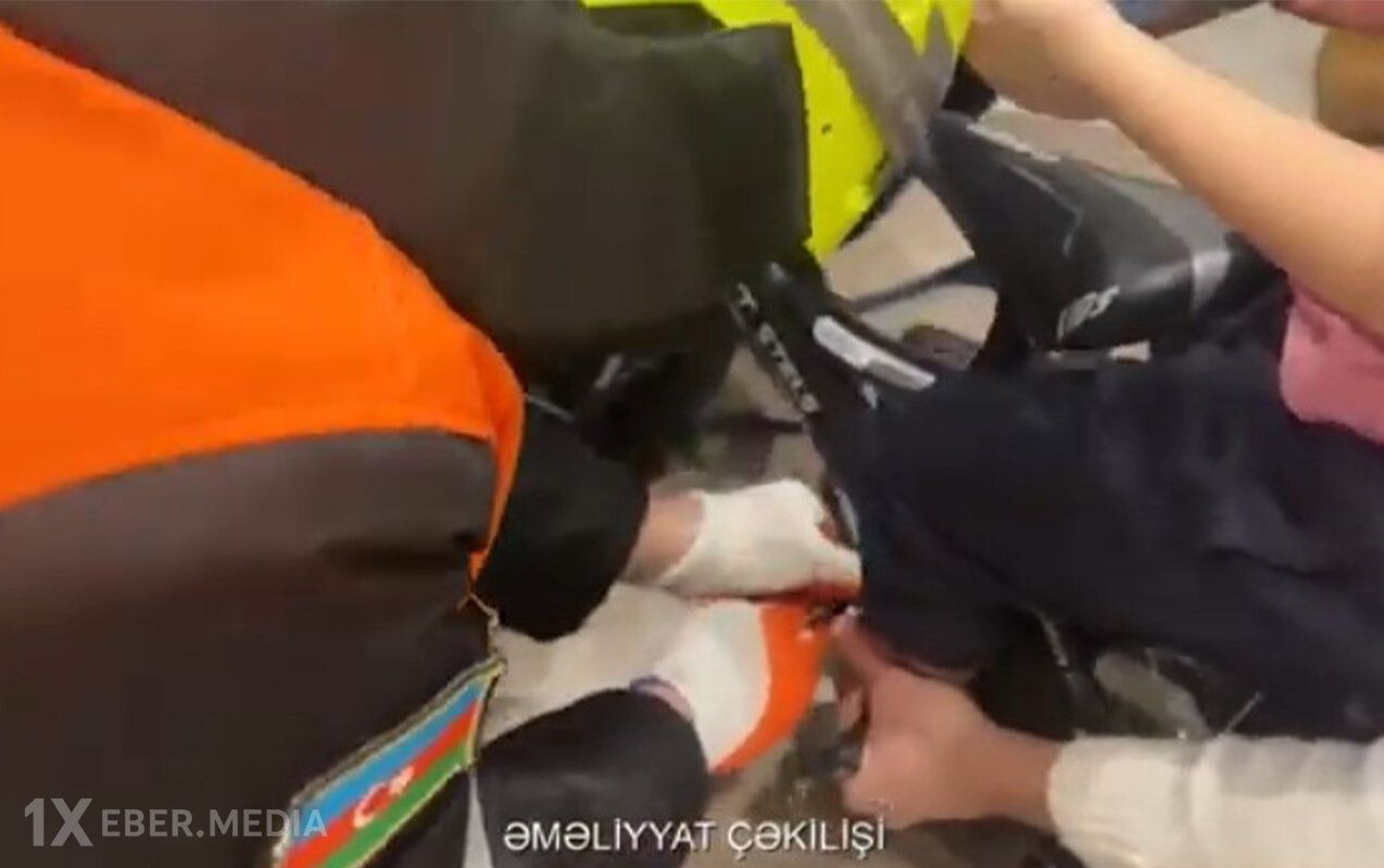 4 yaşlı uşağın ayağı velosipedin pedalına ilişdi - Video