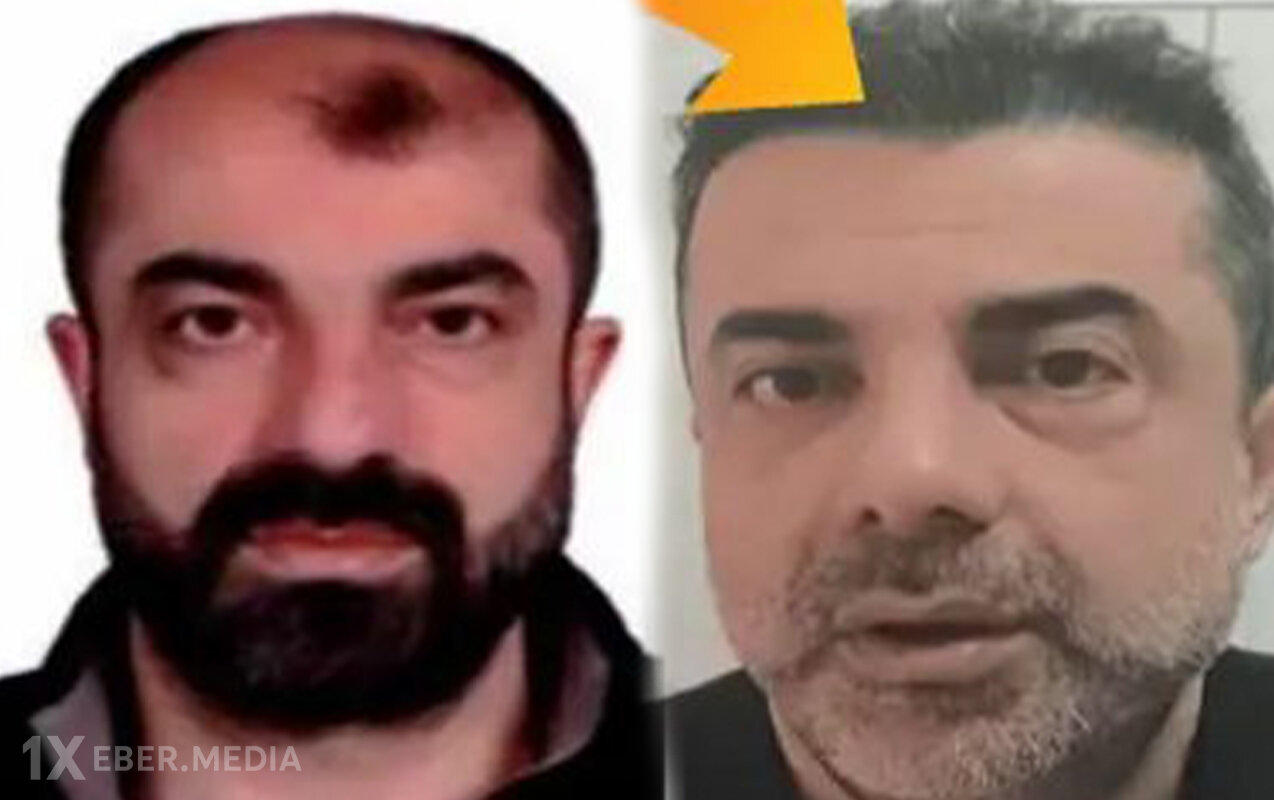 Estetik əməliyyatlarla 7 il gizlənə bildi - Foto