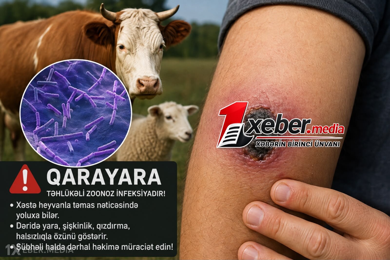 Qarayara zamanı bu əlamətlərə diqqət edin – Həkim xəbərdarlığı