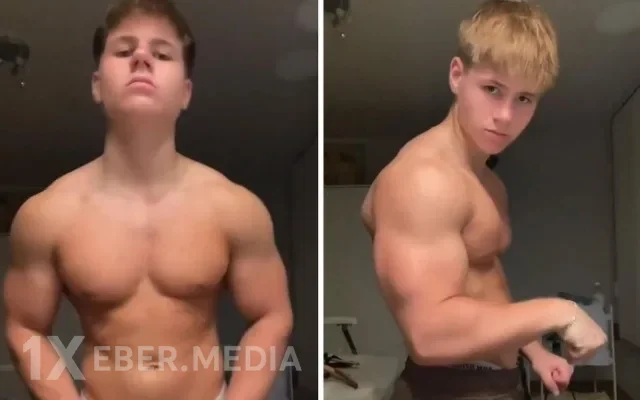 Steroid qəbul edən gəncin son halı gündəm oldu - FOTOLAR