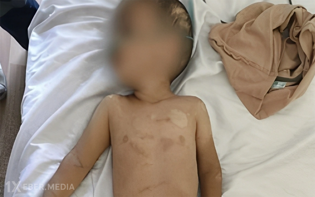 Həmin 3 yaşlı uşağın anasının valideynlik hüququ məhdudlaşdırıla bilər - Foto - Yenilənib